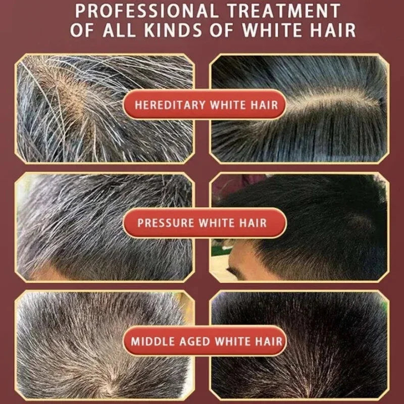 Herbal Hair Dye Shampoo | Natural Hair Coloring Shampoo | 5-Minute Hair Dye Shampoo | Herbal Gray Coverage Shampoo | Natural Hair Color Change Shampoo | Herbal Non-Irritating Hair Dye | Fast Acting Hair Dye Shampoo | Herbal Repairing Hair Color Shampoo | Natural Hair Dye for Men and Women | Herbal Anti-Gray Hair Shampoo