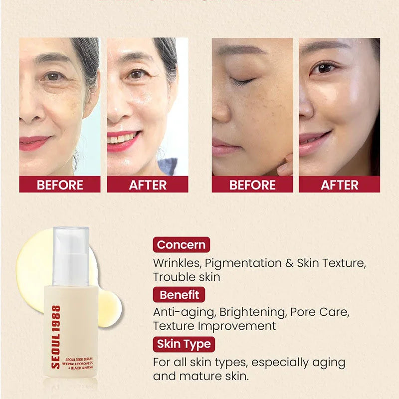 Seoul 1988 Retinal + Black Ginseng Anti-Aging Set