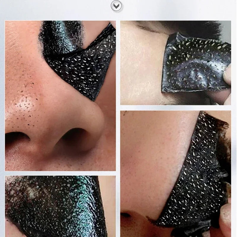 LANBENA Blackhead Remover Nose Mask